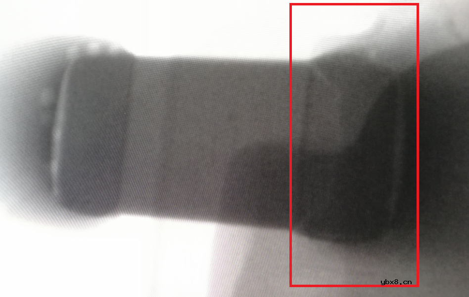 陶瓷电容MLCC失效分析案例