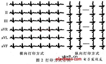 热敏打印机的心电图形快速打印方法