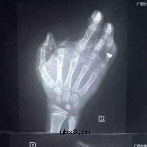 睡前玩手机不仅不利于睡眠，而且在床头充电，还有很大的安全隐患——容易充电爆炸 