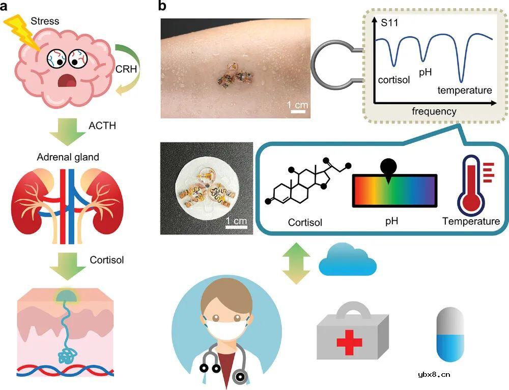 开发一种能够同时记录皮质醇浓度、pH值和温度的可拆卸汗液贴片