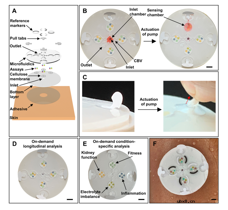 一种用于汗液多靶标按需检测的可穿戴微流控平台