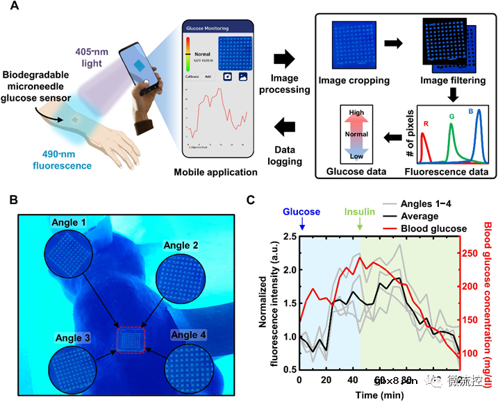 基于荧光的生物可降解微针传感器阵列用于连续血糖监测