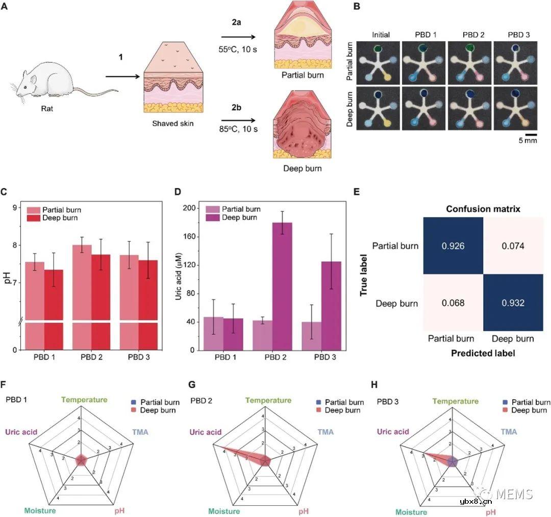 支持人工智能的无电池多路复用传感器贴片可用于伤口监测