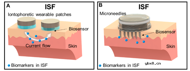 无创血糖监测技术的现状及未来综述