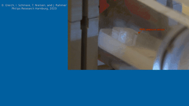 微型化磁机械谐振传感器用于微创医疗和健康监测