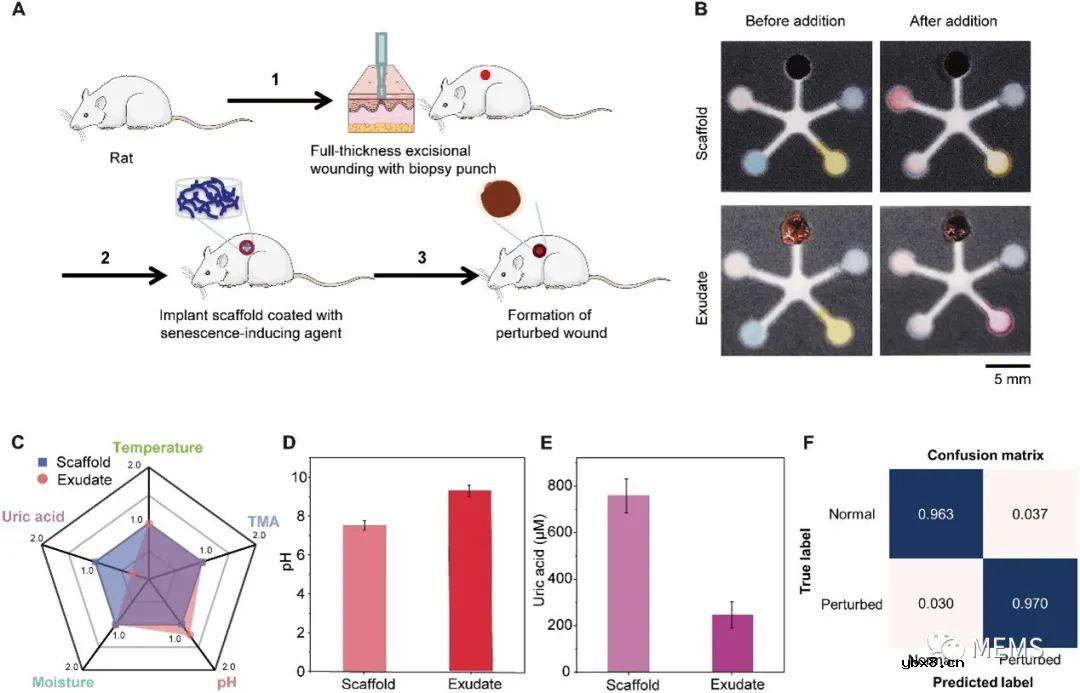 支持人工智能的无电池多路复用传感器贴片可用于伤口监测