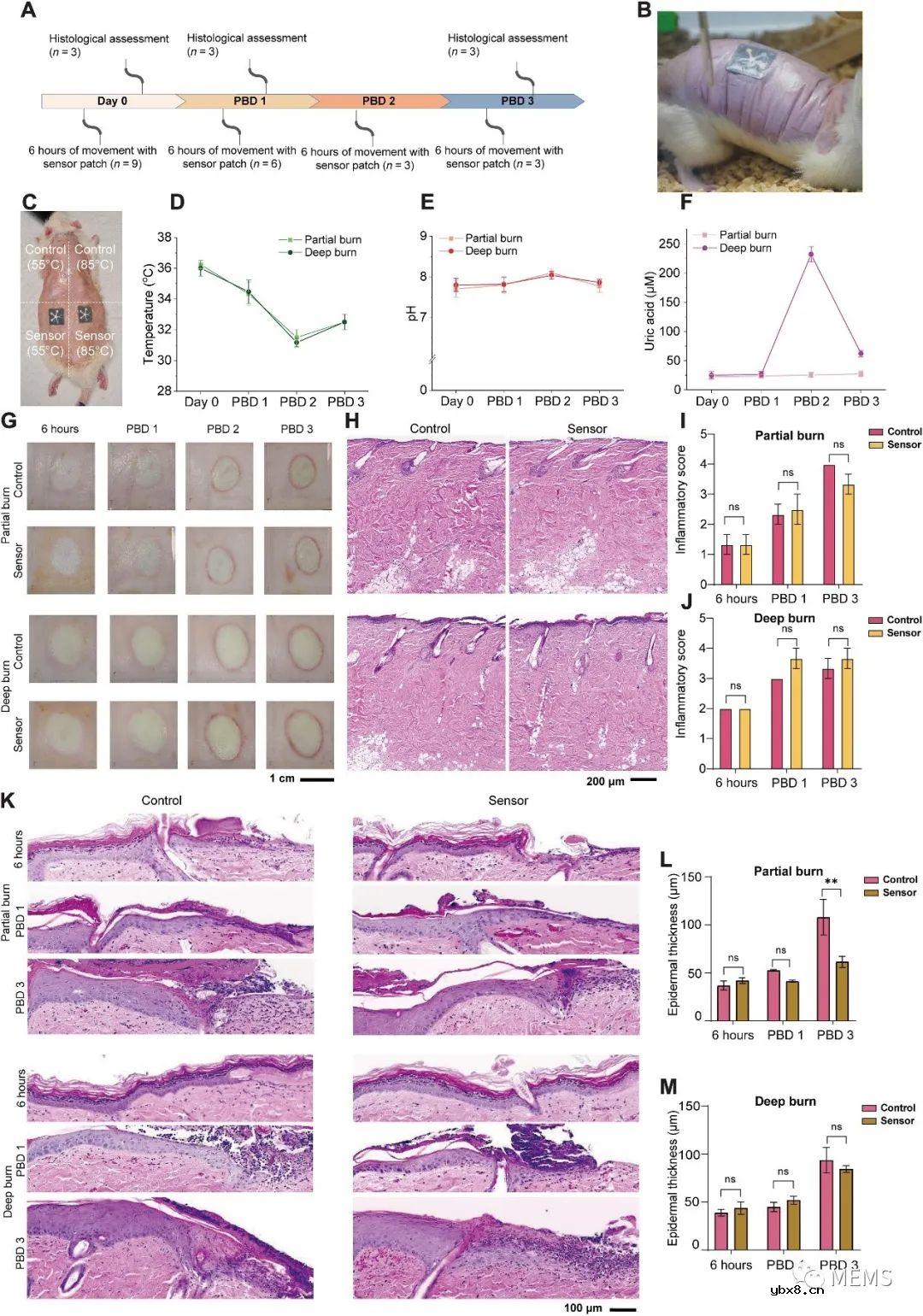 支持人工智能的无电池多路复用传感器贴片可用于伤口监测