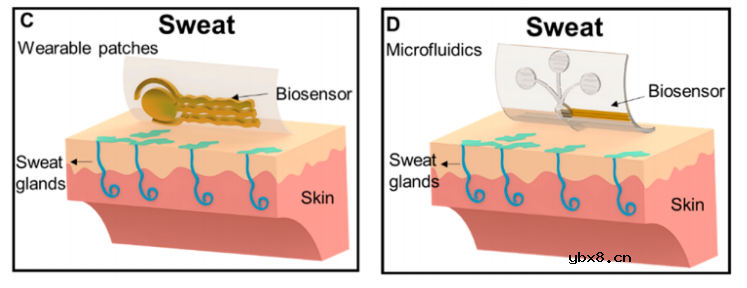 无创血糖监测技术的现状及未来综述