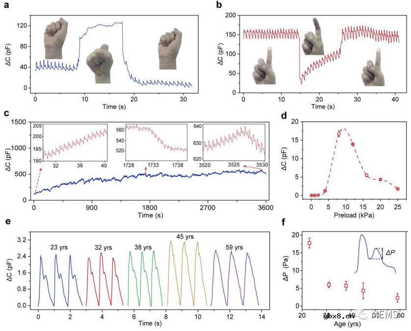 基于可穿戴离子电子传感器单点指尖脉冲监测的动脉硬化评估