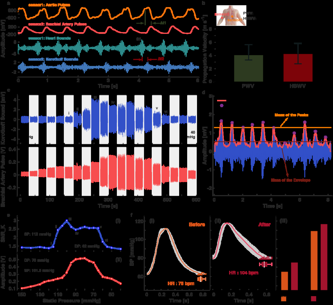 用于聆听身体的声音的可穿戴压电式柔性传感贴片