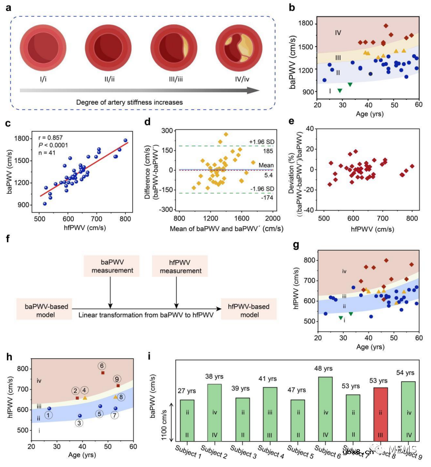基于可穿戴离子电子传感器单点指尖脉冲监测的动脉硬化评估