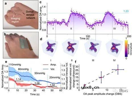 面向无创、连续多参数心血管监测的柔性光声血液听诊器设计