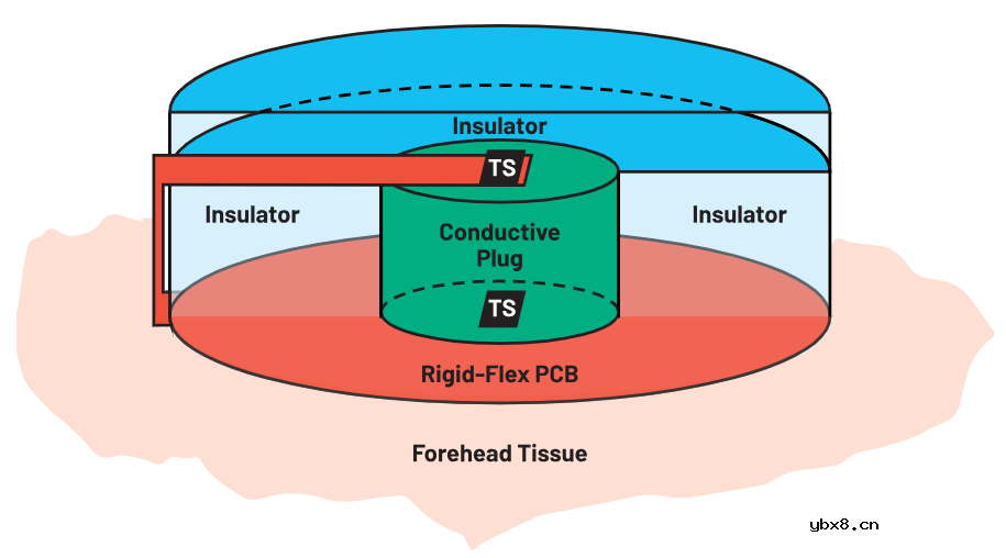 可穿戴温度传感器应用的刚柔结合电路设计方案