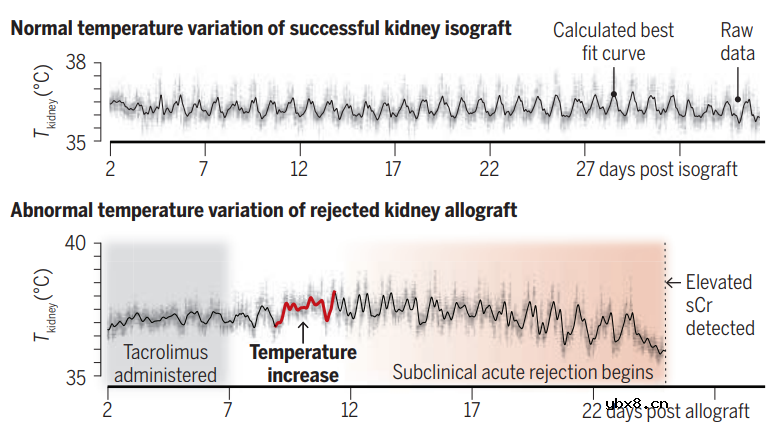 用于肾移植排斥反应早期检测的植入式柔性生物电子系统设计