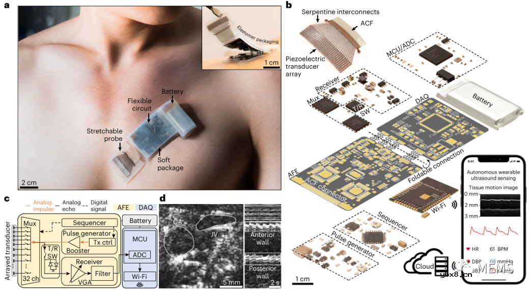 全集成无线可穿戴超声波贴片随时随地监测人体深层组织