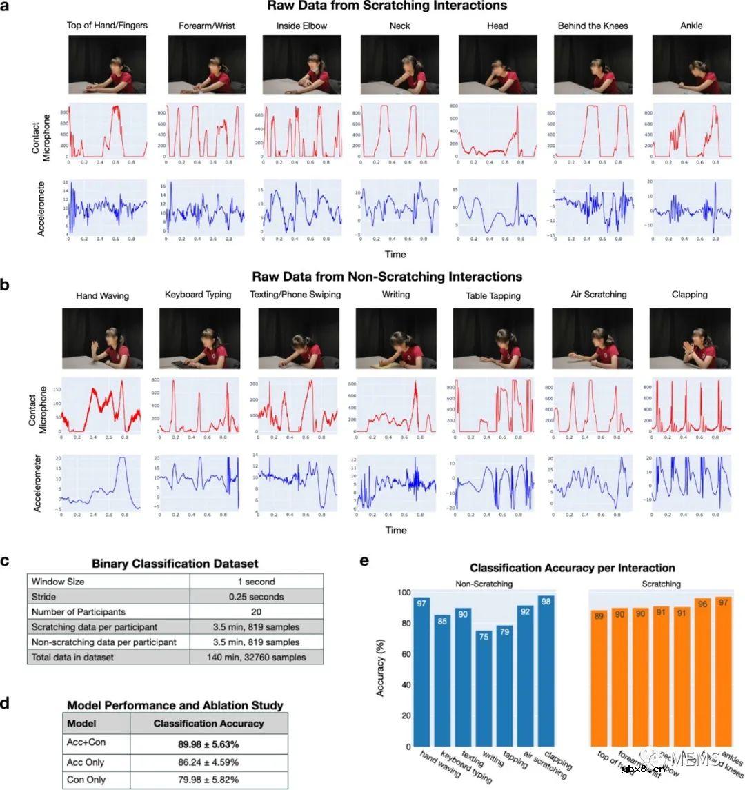 开发一种用于量化皮肤划痕强度的可穿戴多模态传感指环