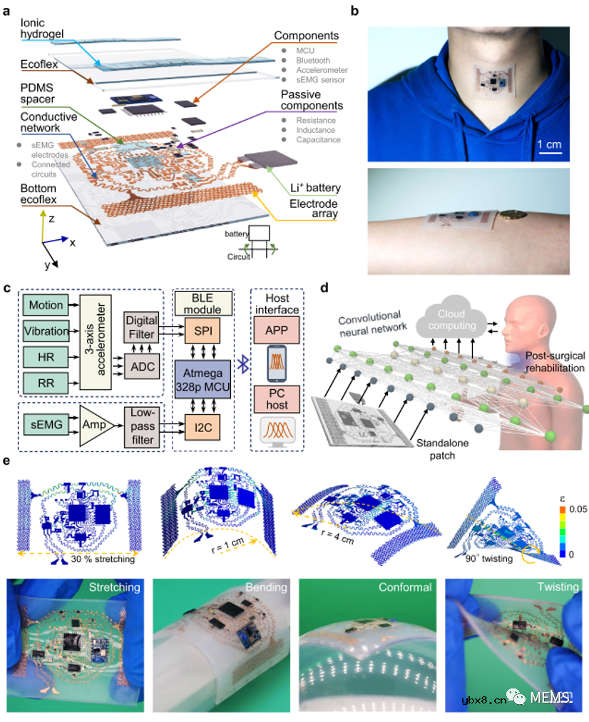 基于传感器的全集成可延展器件平台用于喉部康复监测