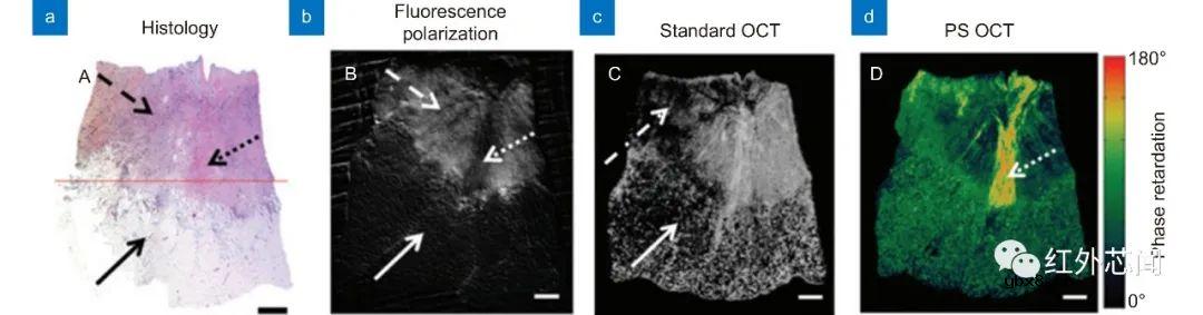 偏振集成红外光电探测器研究进展与应用