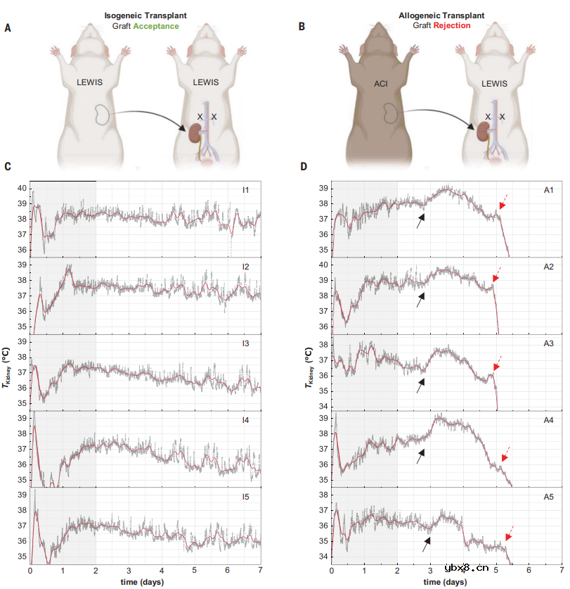 用于肾移植排斥反应早期检测的植入式柔性生物电子系统设计