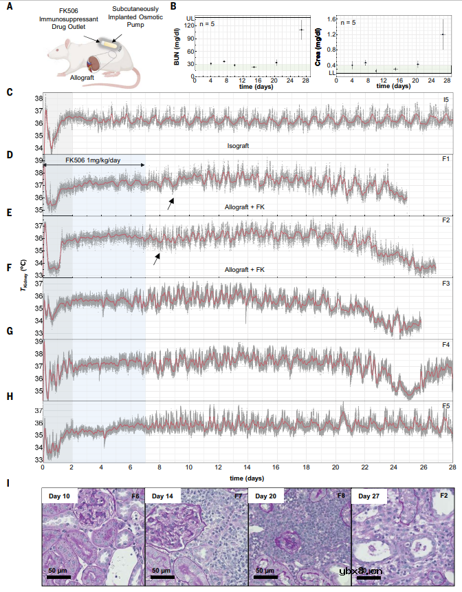 用于肾移植排斥反应早期检测的植入式柔性生物电子系统设计