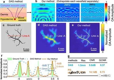 面向无创、连续多参数心血管监测的柔性光声血液听诊器设计