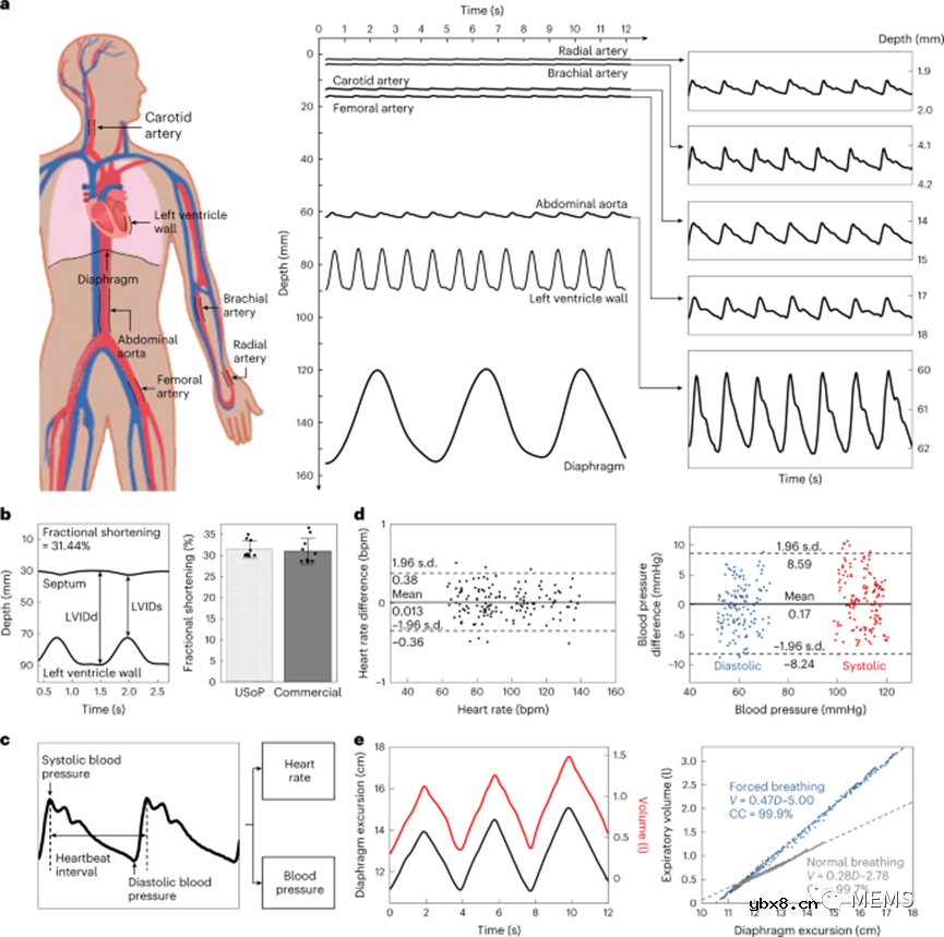全集成无线可穿戴超声波贴片随时随地监测人体深层组织