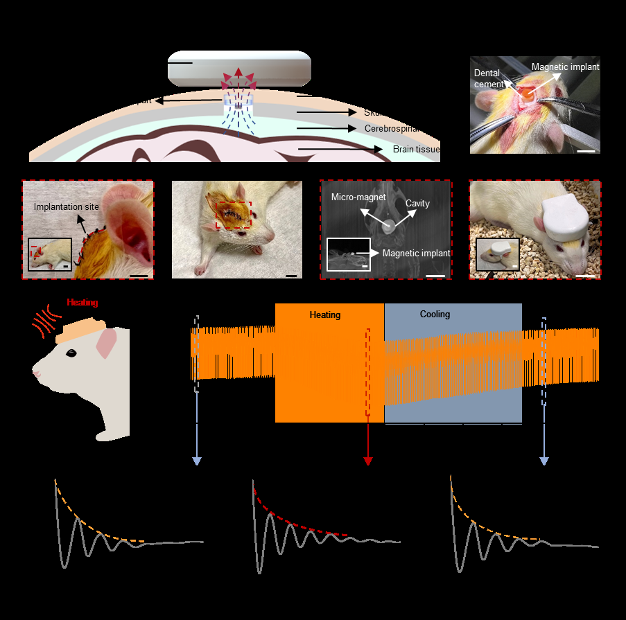 新型植入式传感器+可穿戴设备,实现无线物理生化量传感 新型植入式传感器+可穿戴设备,实现无线物理生化量传感