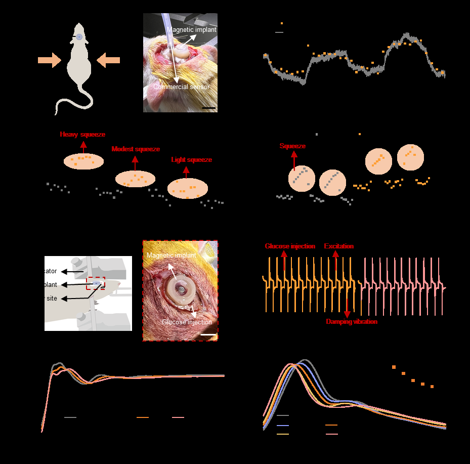 新型植入式传感器+可穿戴设备,实现无线物理生化量传感 新型植入式传感器+可穿戴设备,实现无线物理生化量传感
