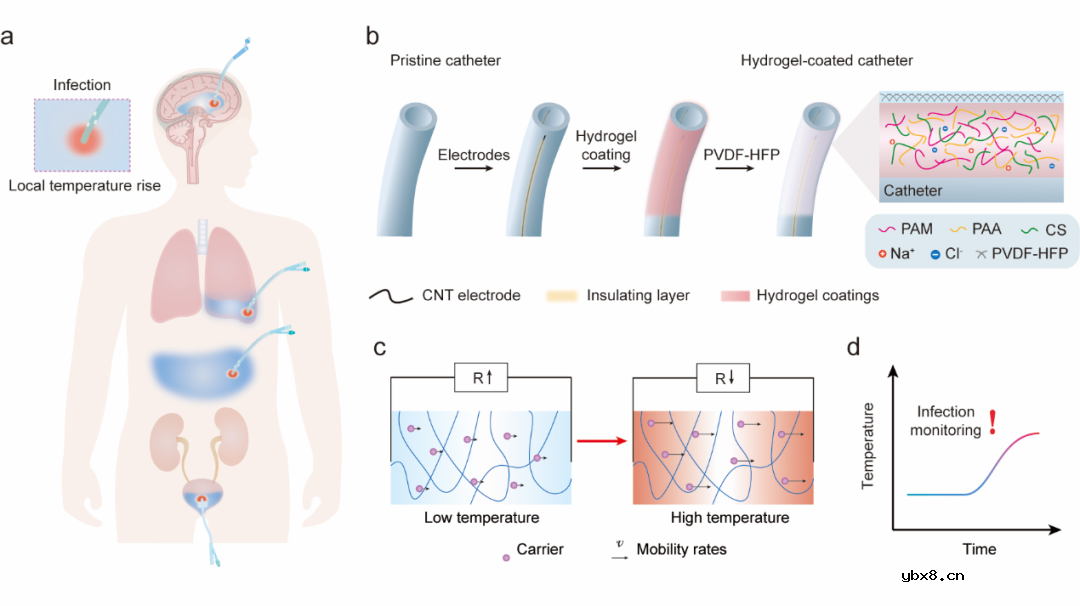 生物匹配的高分子植入式传感器，实现疾病的早期精准检测