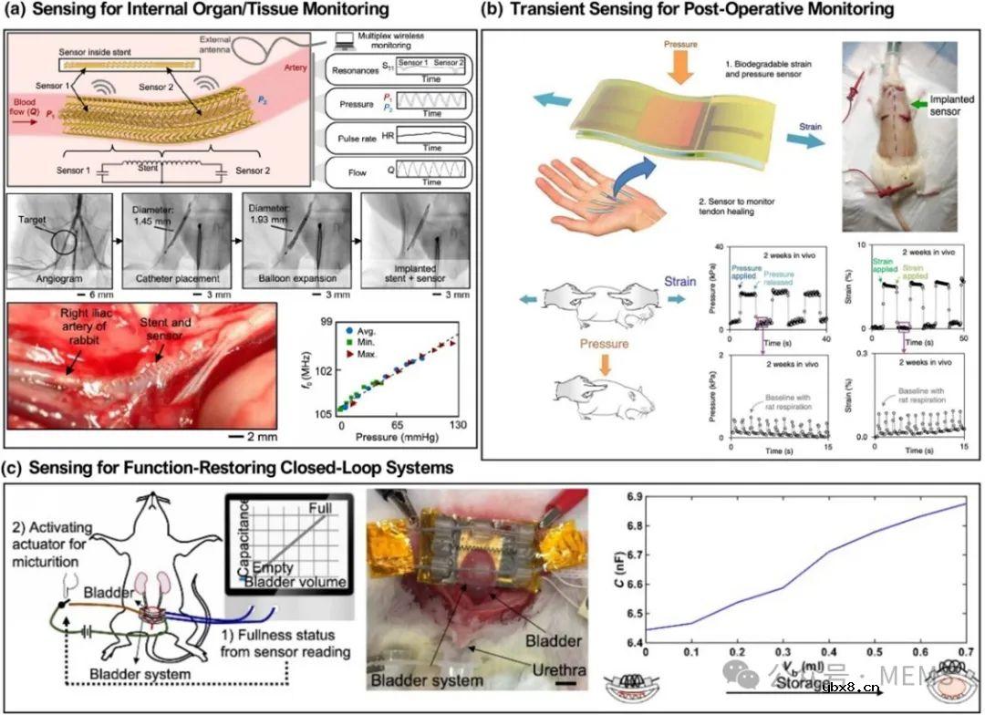面向穿戴式和植入式应用的软体机械传感器综述