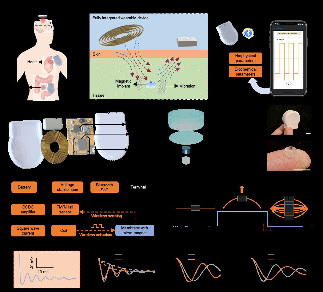 新型植入式传感器+可穿戴设备,实现无线物理生化量传感 新型植入式传感器+可穿戴设备,实现无线物理生化量传感