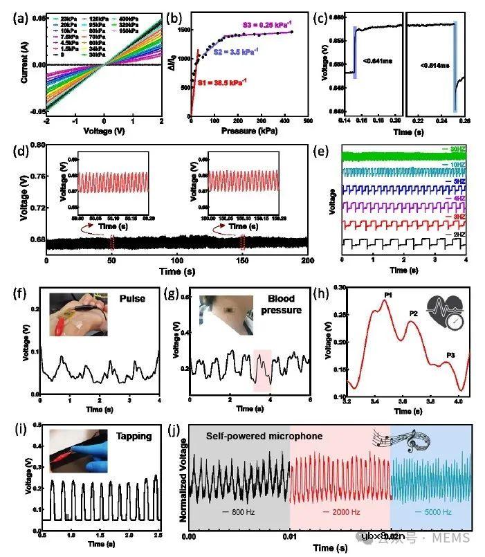 基于新型复合水凝胶的压阻式压力传感器,可用于各种生物医学应用 基于新型复合水凝胶的压阻式压力传感器,可用于各种生物医学应用