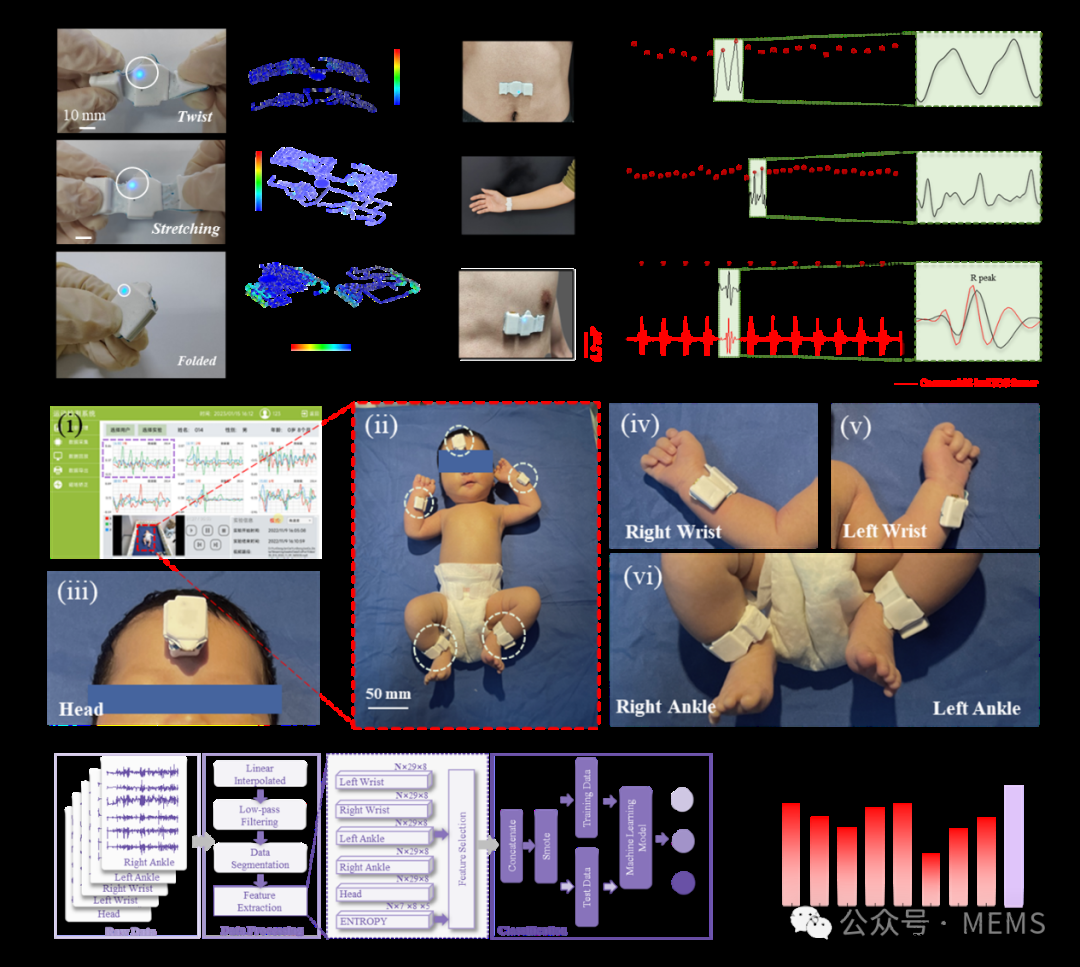 基于柔性无线IMU传感器的稀疏传感网络，用于新生儿脑瘫快速筛查