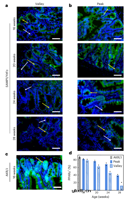 用于长期监测慢性肠道炎症的微型植入式温度传感器