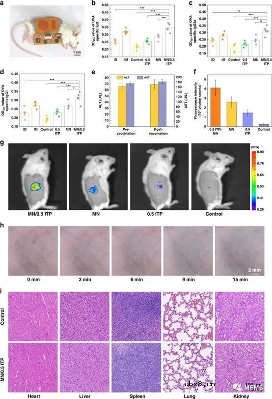 一种可穿戴式离子电渗驱动的微针贴片设计